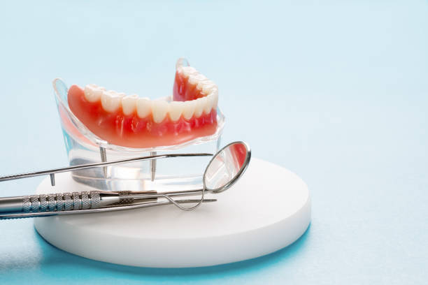 Dental Inlays and Onlays in Kaser, NY