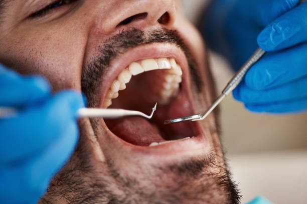 Full Mouth Reconstruction in Kaser, NY
